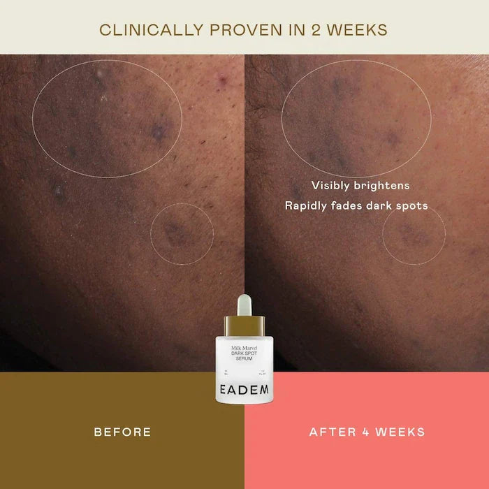 Milk Marvel Dark Spot Serum with Niacinamide and Vitamin C