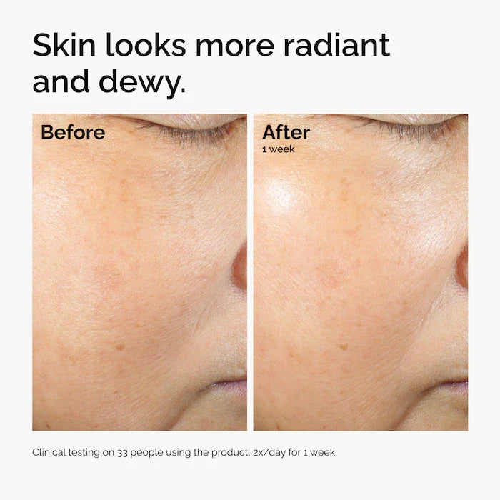 Rice Lipids + Ectoin Microemulsion Moisturizer for Soothing Hydration & Reduced Redness