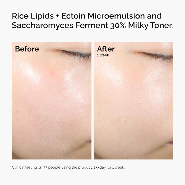 Rice Lipids + Ectoin Microemulsion Moisturizer for Soothing Hydration & Reduced Redness