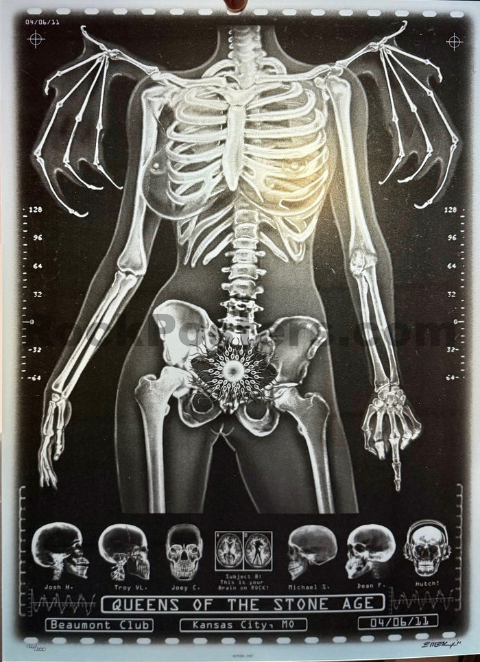 AUCTION - Queens of the Stone Age - Kansas City '11 - X-Ray Skeleton - 1st Edition - Emek - Mint-5175077-3860462